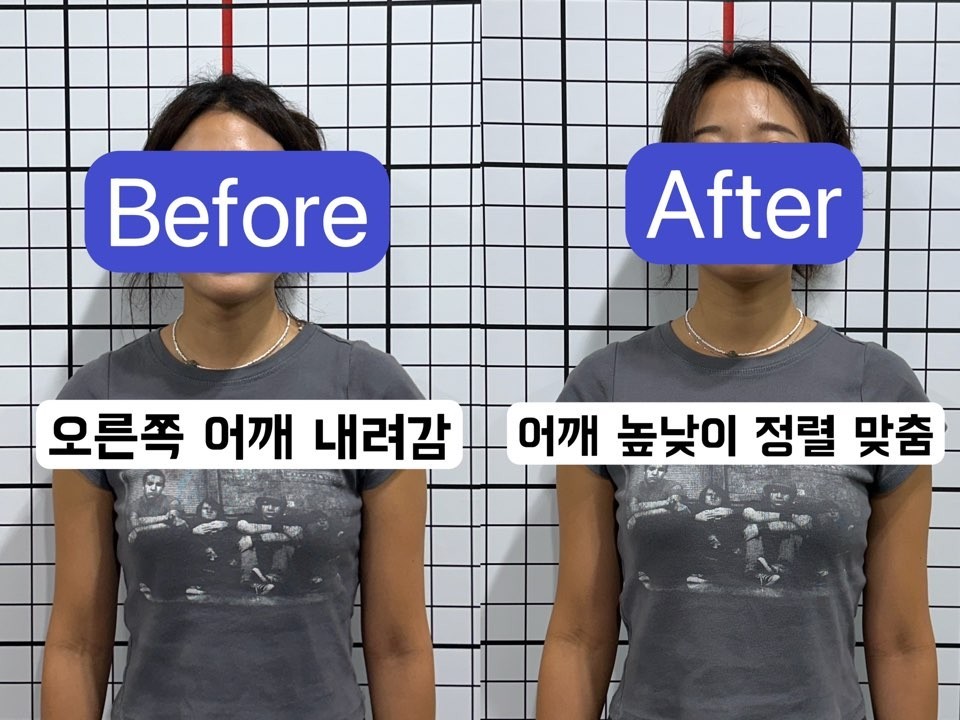 [고양/교정] 베OO바디