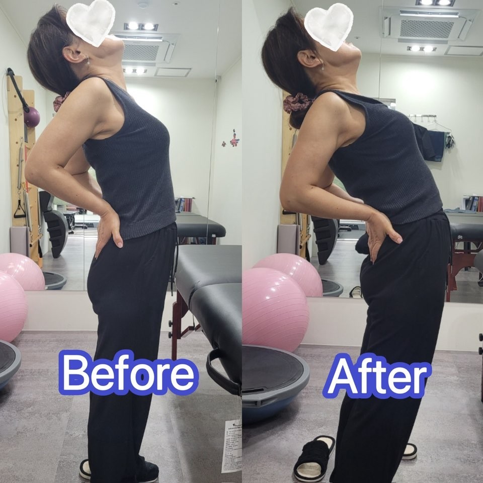 [쇼츠/고양/교정] 베OO바디