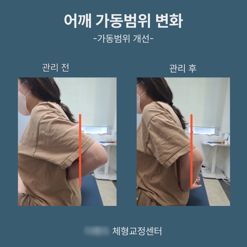 [포토/부산/교정] 더OO 체형교정센터