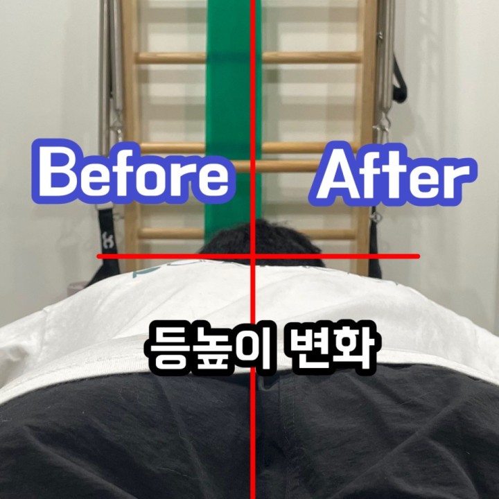 [고양/교정] 베OO바디