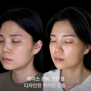 로OOO떼 서초 잠OO점