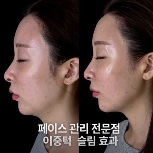 로OOO떼 서초 잠OO점