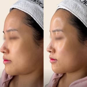 로OOO떼 서초 잠OO점