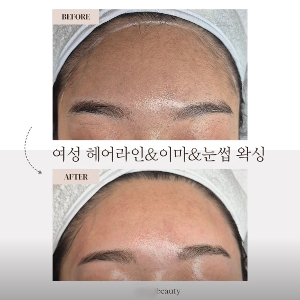 [수원] 종류별 왁싱 중 택1