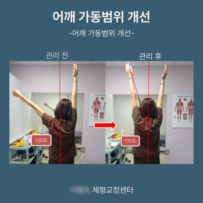 [크기변환]1. 블로그.png