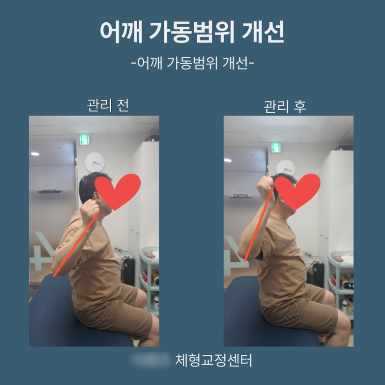 [크기변환]2. 클립.png