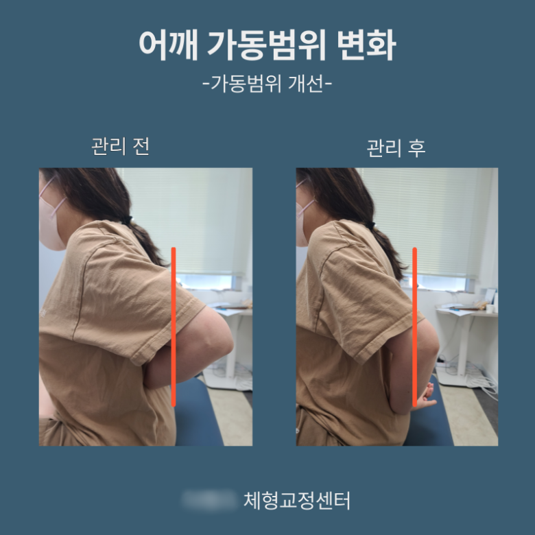 [크기변환]3. 포토.png