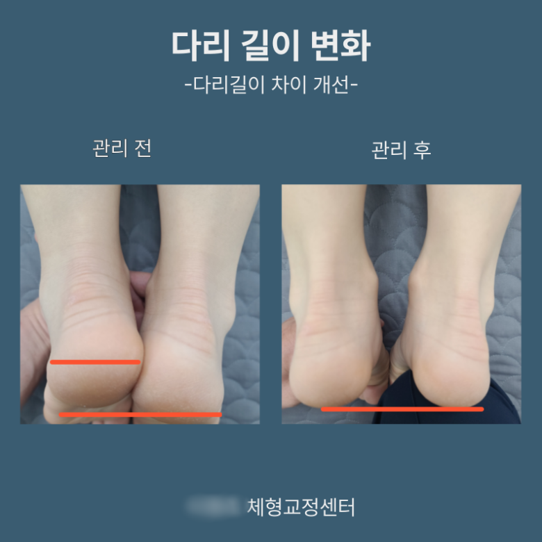 [크기변환]다운로드 (4).png