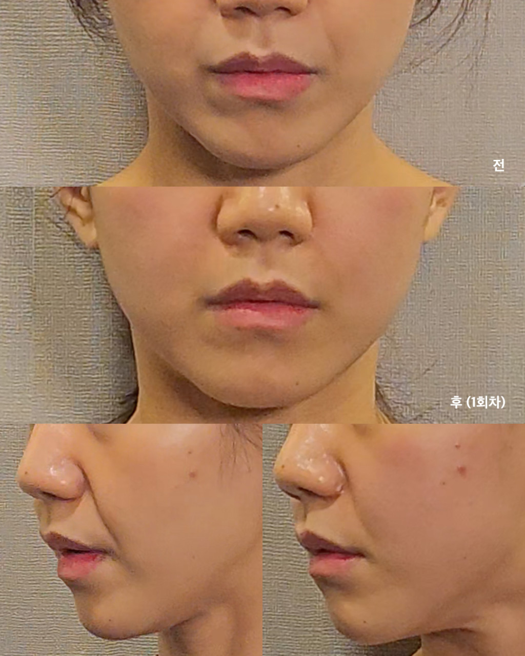 다운로드 (1).jpg